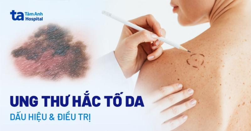 Minh hoa khoa hoc cach te bao hac to tao thanh not ruoi